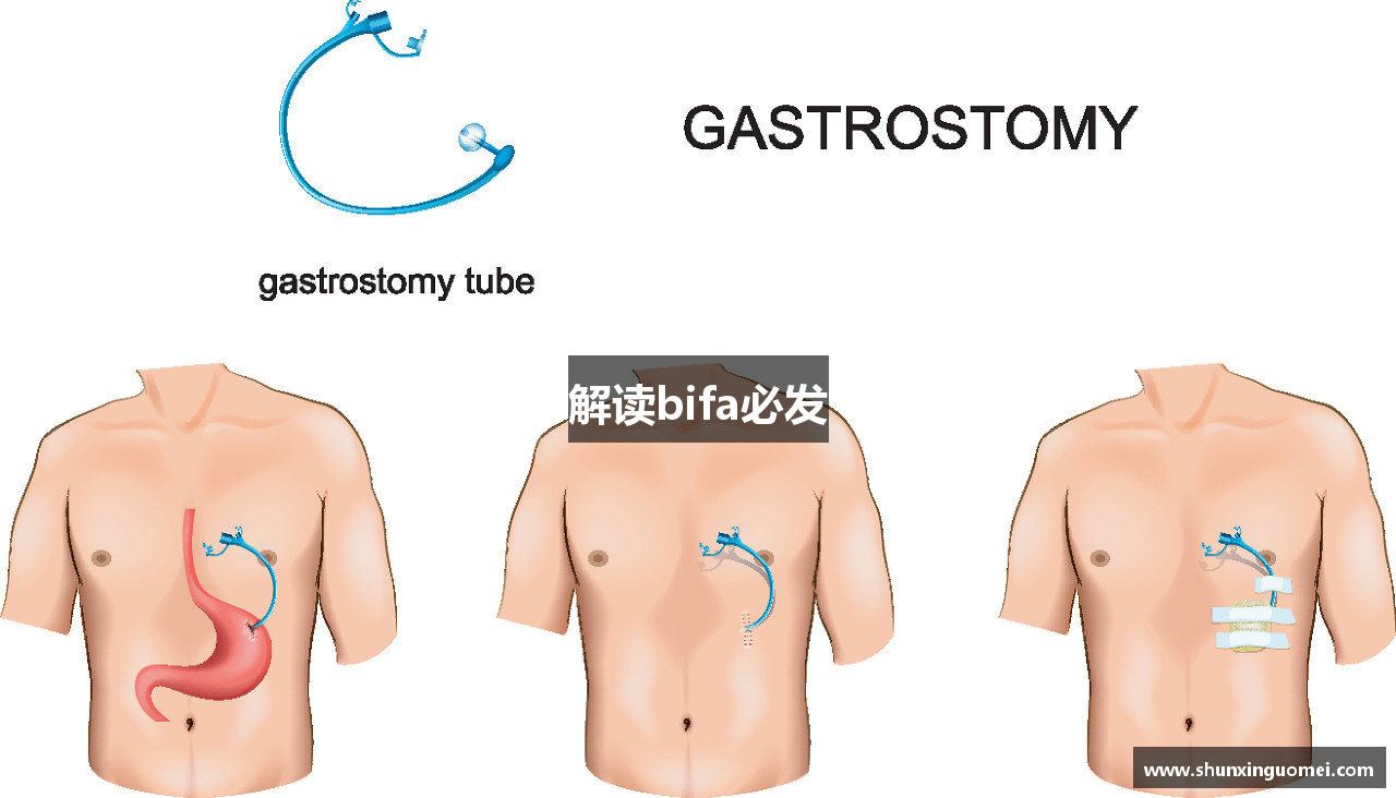 解读bifa必发